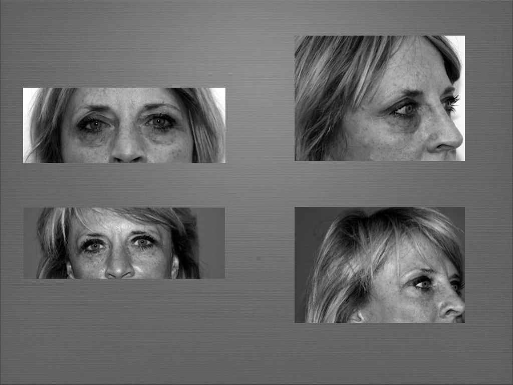 Chirurgie esthétique du visage à Marseille - Dr Frédéric Germain