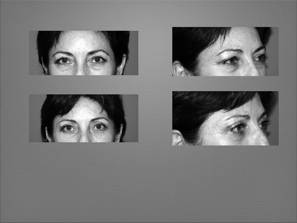 Chirurgie esthétique du visage à Marseille - Dr Frédéric Germain