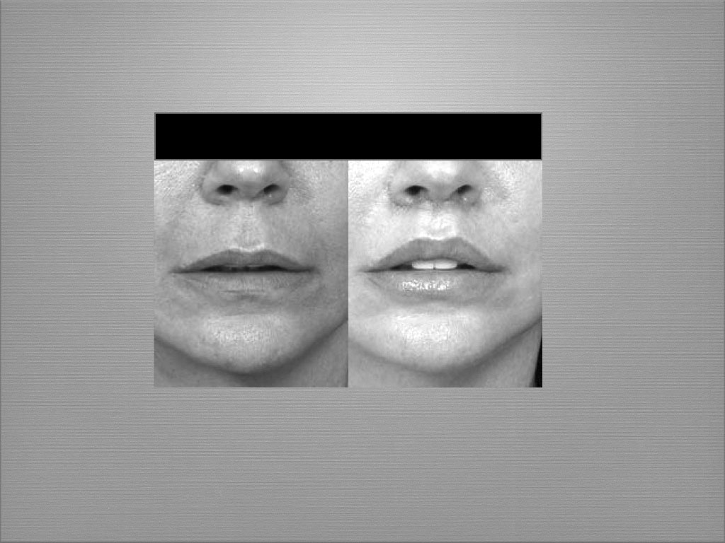 Chirurgie esthétique du visage à Marseille - Dr Frédéric Germain